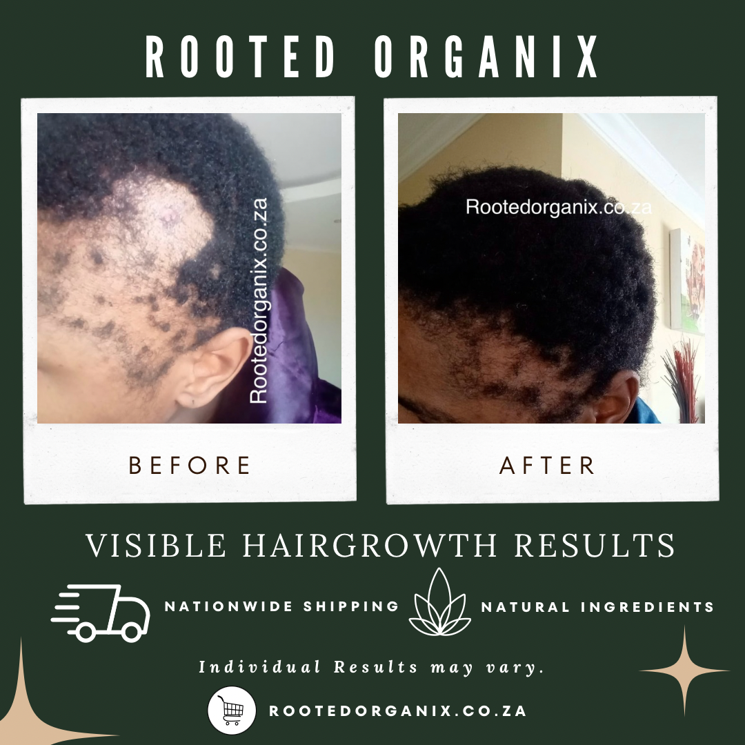 xy Skincare Xnstagram Post - 2