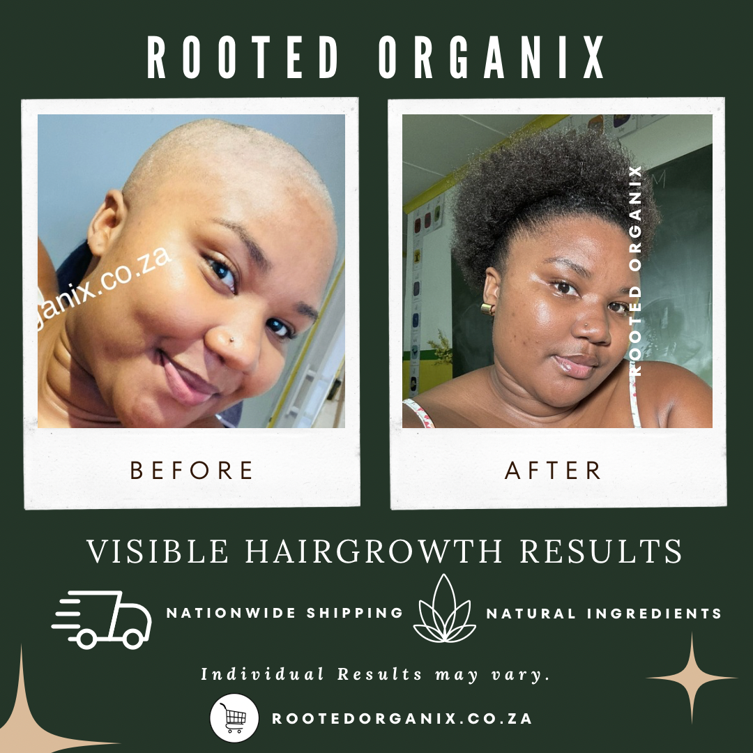 Before After Beauty Skincare Minimlasit Instagram Post - 3